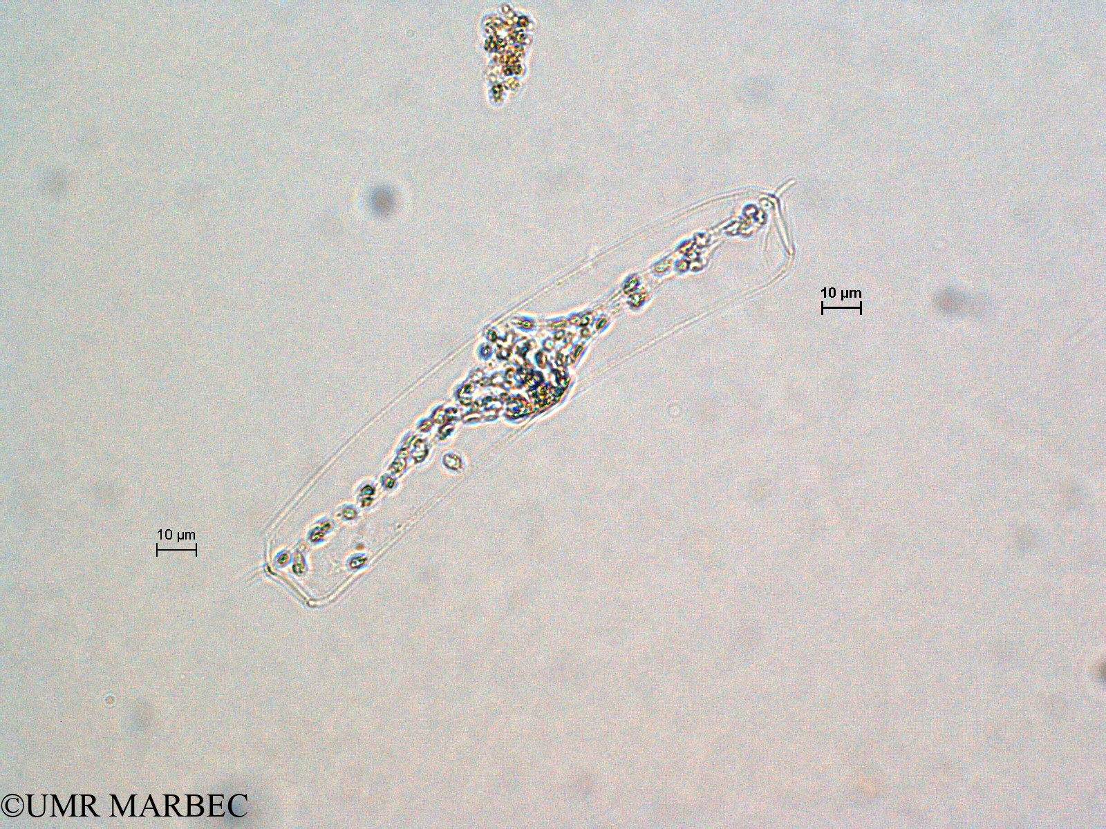 phyto/Scattered_Islands/all/COMMA April 2011/Guinardia striata (G. sp2 cf delicatula -11)(copy).jpg